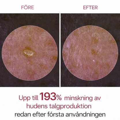 Peel Shot - Klarere hud uten synlige porer